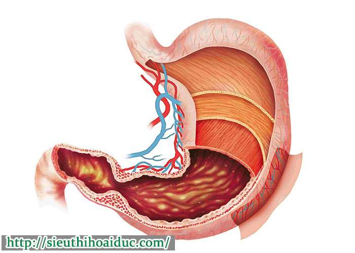 Đau Dạ Dày Cấp